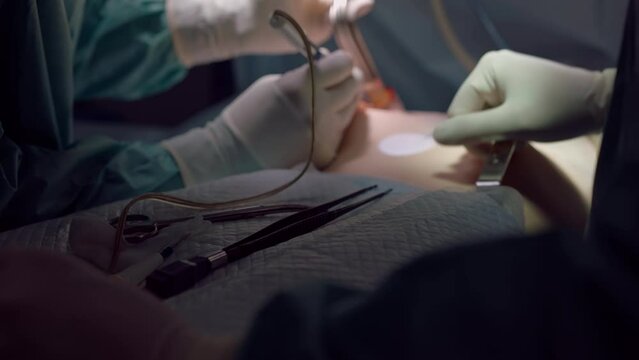 Close-up medical tools with unrecognizable surgeon performing breast augmentation operation in slow motion. Professional doctor cleaning body of patient for implant placement on surgical table