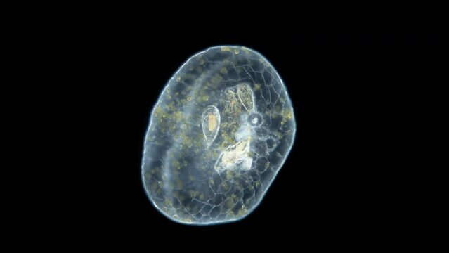 Worm Turbellaria, order Acoela under a microscope. One can see the statocyst: organ of balance and the perchyma, where food is digested. Indian ocean