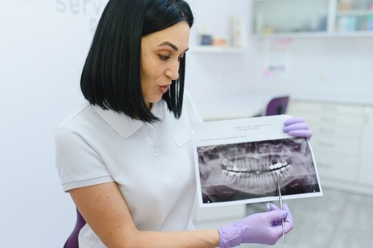 Dentist show by her finger on the milk tooth on the x-ray teeth image close up.