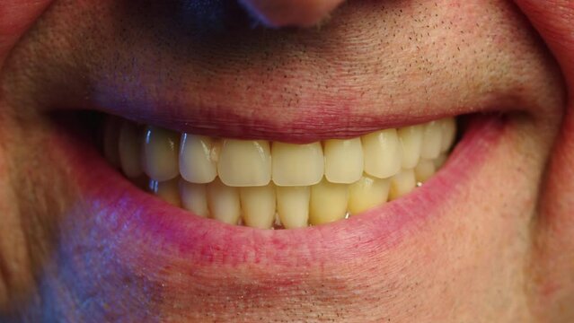 Close-up smile of an elderly man with artificial teeth. Periodontal disease and missing teeth in an elderly man. Close up shot of a toothless male mouth