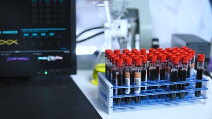 Test tubes with blood samples standing on desk near computer, laboratory examination - obrazy, fototapety, plakaty