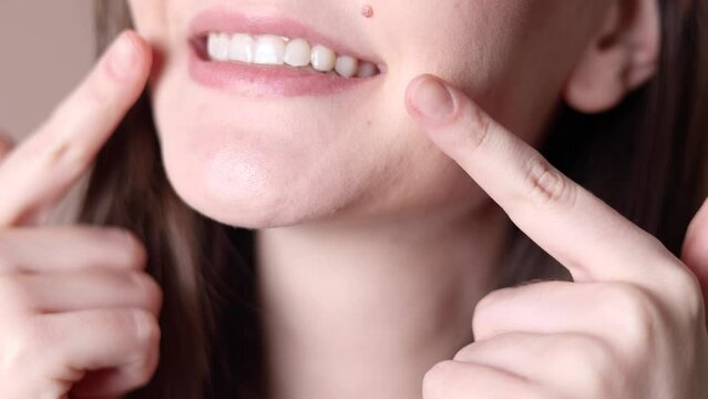 A young girl uses aligners to straighten her teeth