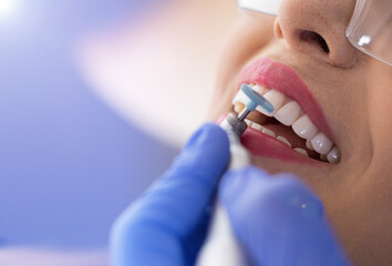 woman with beautiful smile being attended by dentist