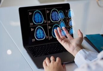 Brain x ray graphic, clinic results and doctor hands with digital report about neurology work....
