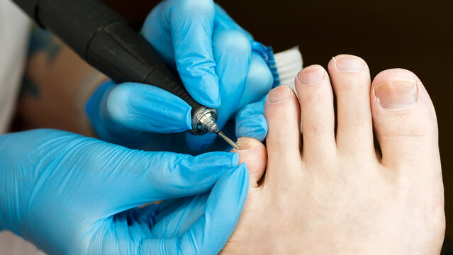 Hardware pedicure procedure