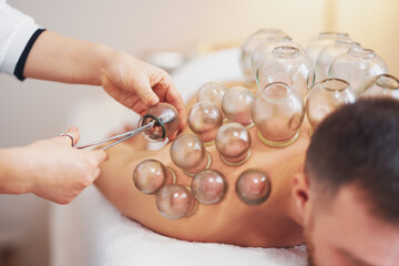 A picture of a man having cupping therapy
