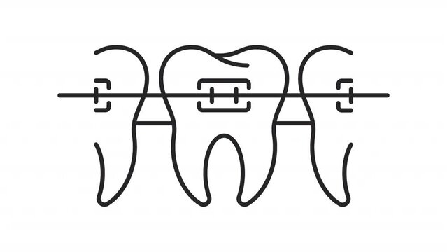 Animated braces linear icon. Orthodontic procedure. Dentistry. Teeth alignment. Seamless loop HD video with alpha channel on transparent background. Outline motion graphic animation