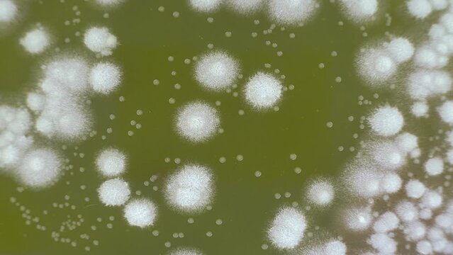 testing samples to check for the presence of pathogens in public places. Laboratory research in petri dishes