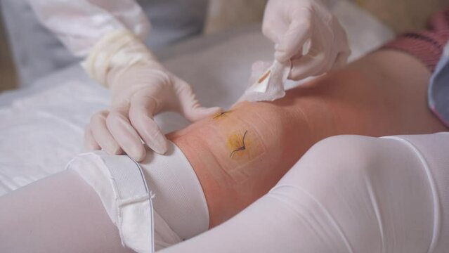 Close-up of a medical dressing, replacement of a sterile patch with iodine solution for postoperative stitches on the knee joint.