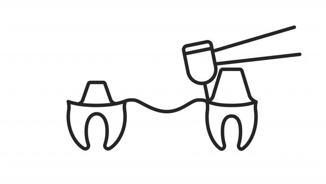 Animated dental bridge linear icon. Artificial teeth. Replace missing tooth. Dental procedure. Seamless loop HD video with alpha channel on transparent background. Outline motion graphic animation