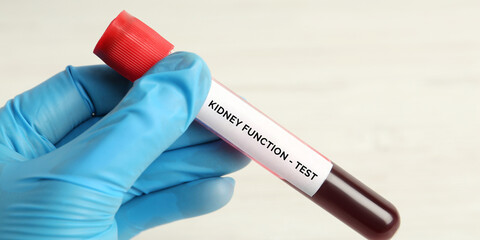A Scientist or Lab technician holding a tube with a blood sample and labeling the Kidney function test on white background, closeup. Health and medical concept.
