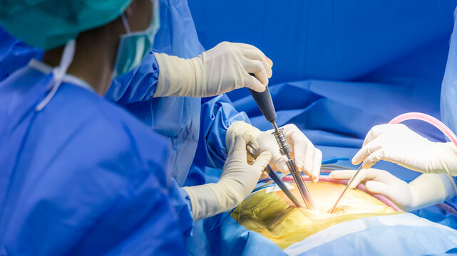 Team of spine surgeon or doctor in blue uniform inside orthopedic operating room in hospital.People did spinal surgery.Hand of surgeon with medical instrument or equipment.Pedicular screw was implant.