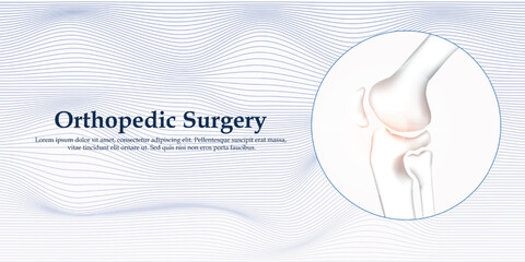 This medical-themed vector of orthopedic treatment for traumatology of knee bones injury, set in a modern hospital, this vector is the perfect visual aid for medical presentations.