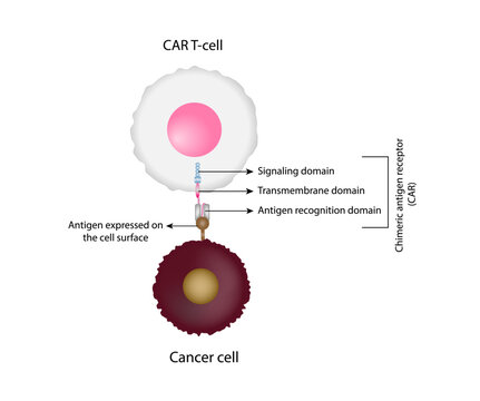 CAR T-cell therapy and Cancer treatment . Chimeric antigen receptor T cells. T cell receptor proteins that have been engineered to kill cancer ells. CAR T cells immunotherapy. Cancer therapy. Vector