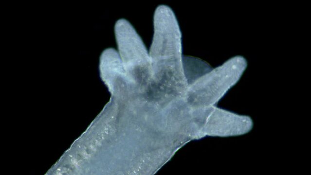 Aulophorus sp worm under a microscope, family Naididae. Lives in water contaminated with organic residues. At the end has gills similar to tentacular appendage.