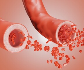 normal blood vessel and widening blood vessels, Vasodilation, also known as vasorelaxation, is the widening of blood vessels 3d rendering