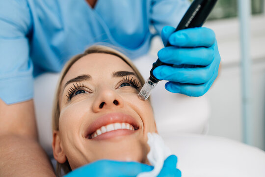 Microneedle mesotherapy. Beautiful woman receiving microneedling rejuvenation treatment.