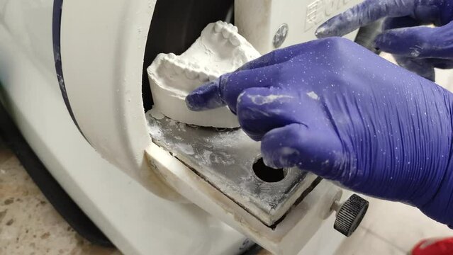 Dental technician grinding a gypsum cast of teeth