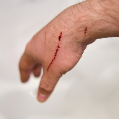Scratch with running blood on a man hand from a cat