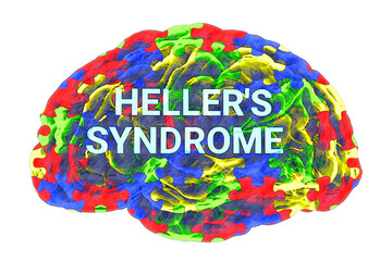 A conceptual 3D illustration featuring the text Heller's syndrome inside the anatomical model of a human brain with a colorful puzzle pattern on its surface