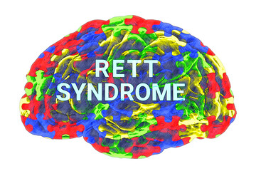 A conceptual 3D illustration featuring the text Rett syndrome inside the anatomical model of a human brain with a colorful puzzle pattern on its surface