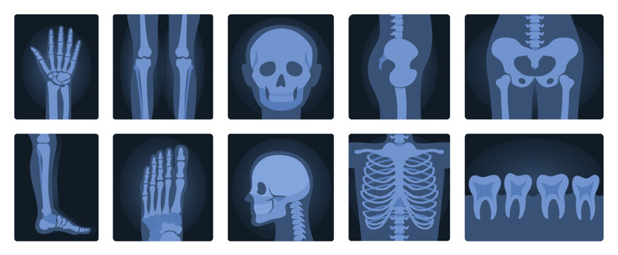 Xrays films of human body set, radiography and anatomy vector illustration. Cartoon isolated medical roentgen scans with silhouettes of bones of skeleton, joint and articulation of legs and hands