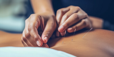 The doctor sticks needles into the girl's body on the acupuncture. digital ai art

