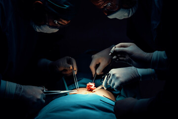 Surgical team performing surgery to patient in sterile operating room. In a surgery room lit by a...