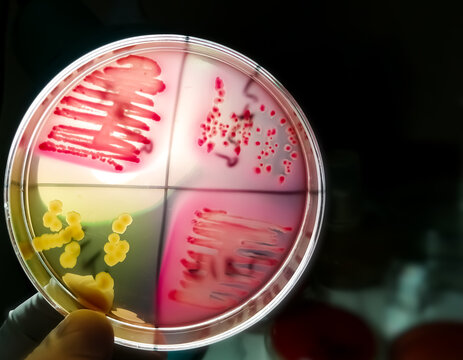 Bacteria colony on culture media plate, stool culture