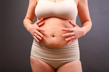 young woman in postpartum corrective tightening underwear shows her overweight. The girl squeezes...