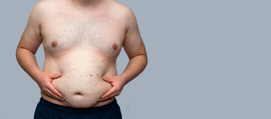 obese man holding his stomach