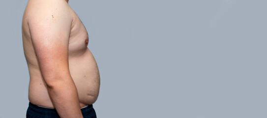 obese man from the side showing belly