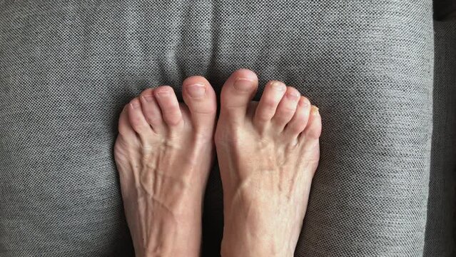 View from above women's feet. Toes. Concept problem with nails, medicine, pedicure