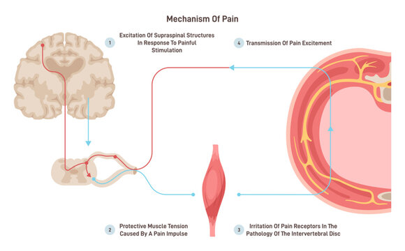 Anatomy and physiology of pain. CNS reaction or reflex on painfull