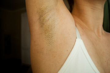 Hair on a woman's armpit. Concept of body naturalness self love. Hair removal.Armpit stubble.
 - obrazy, fototapety, plakaty