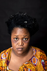 Poor South African Female Portrait