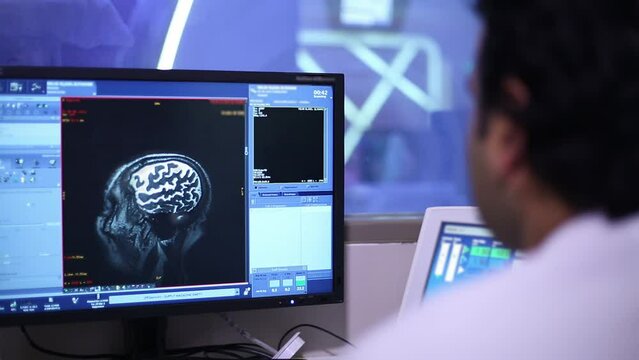 Computed tomography of the brain. The doctor examines the result of the brain CT scan