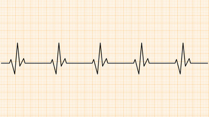 Ecg paper with heart beat graph