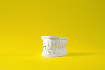 Jaw. Plaster model of the upper and lower jaw. Tooth model. High quality photo.