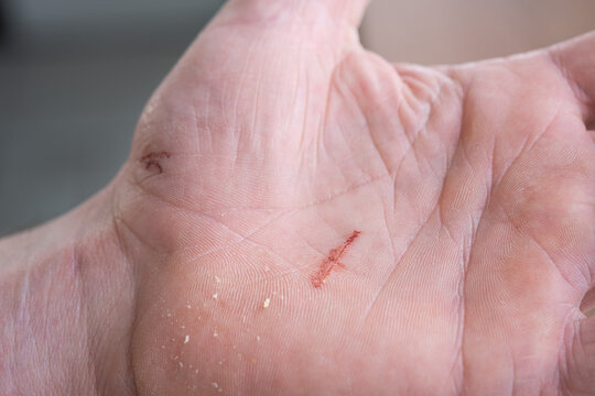 A cut on a man's palm in close-up. Household skin damage with a sharp cutting object, first aid