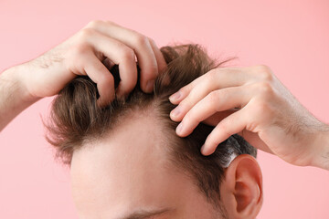 Young man with hair loss problem on pink background, closeup