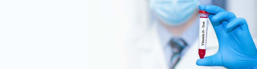 Doctor holding a test blood sample tube with Vitamin D test. Banner. Copy space for text.