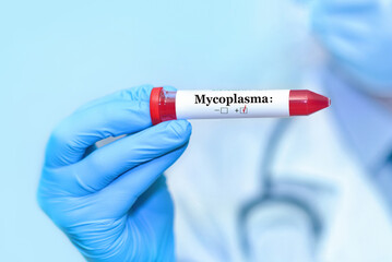 Doctor holding a test blood sample tube positive with Mycoplasma test on the background of medical...