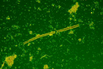Obraz na płótnie Canvas Microscopic view of various species of planktonic freshwater algae. Rheinberg illumination.