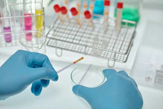 Close-up of gloved hands of chemist holding paper indicator of ph acid over petri dish while carrying out experiment in clinical laboratory