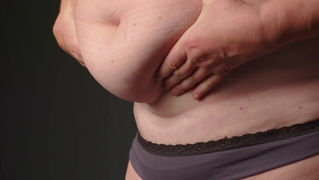 Close up of fat woman. Woman folds of skin and fat on stomach. Weight loss or weight gain. Bad food and unhealthy food