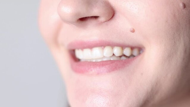 A young girl uses aligners to straighten her teeth
