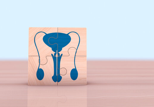 Erectile dysfunction, priapism, Peyronie's disease, orchitis, varicocele, hydrocele. Donor and Organ Donor. Wooden cubes on a light blue background.