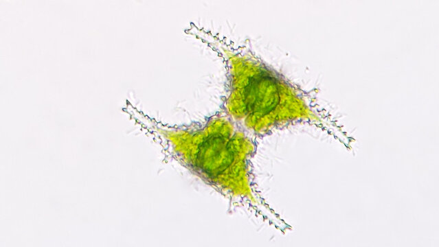 Freshwater plankton genus Staurastrum. The species probably Staurastrum manfeldtii. 40x objective lens. Live cell. Selective focus image