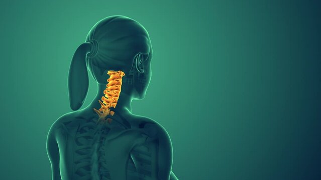 Cervical postural syndrome or pain in the neck